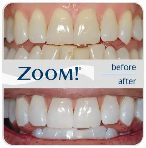 Carmel, Indiana dentist